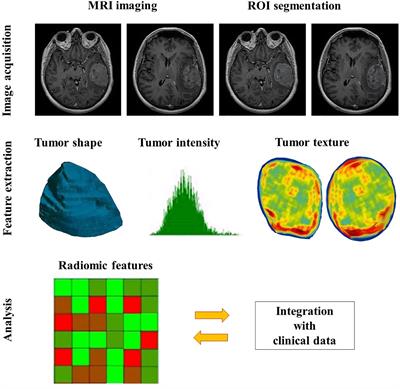 Frontiers | The Current State Of Radiomics For Meningiomas: Promises ...